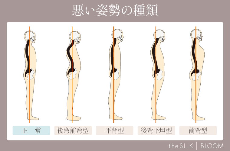 悪い姿勢の種類の画像